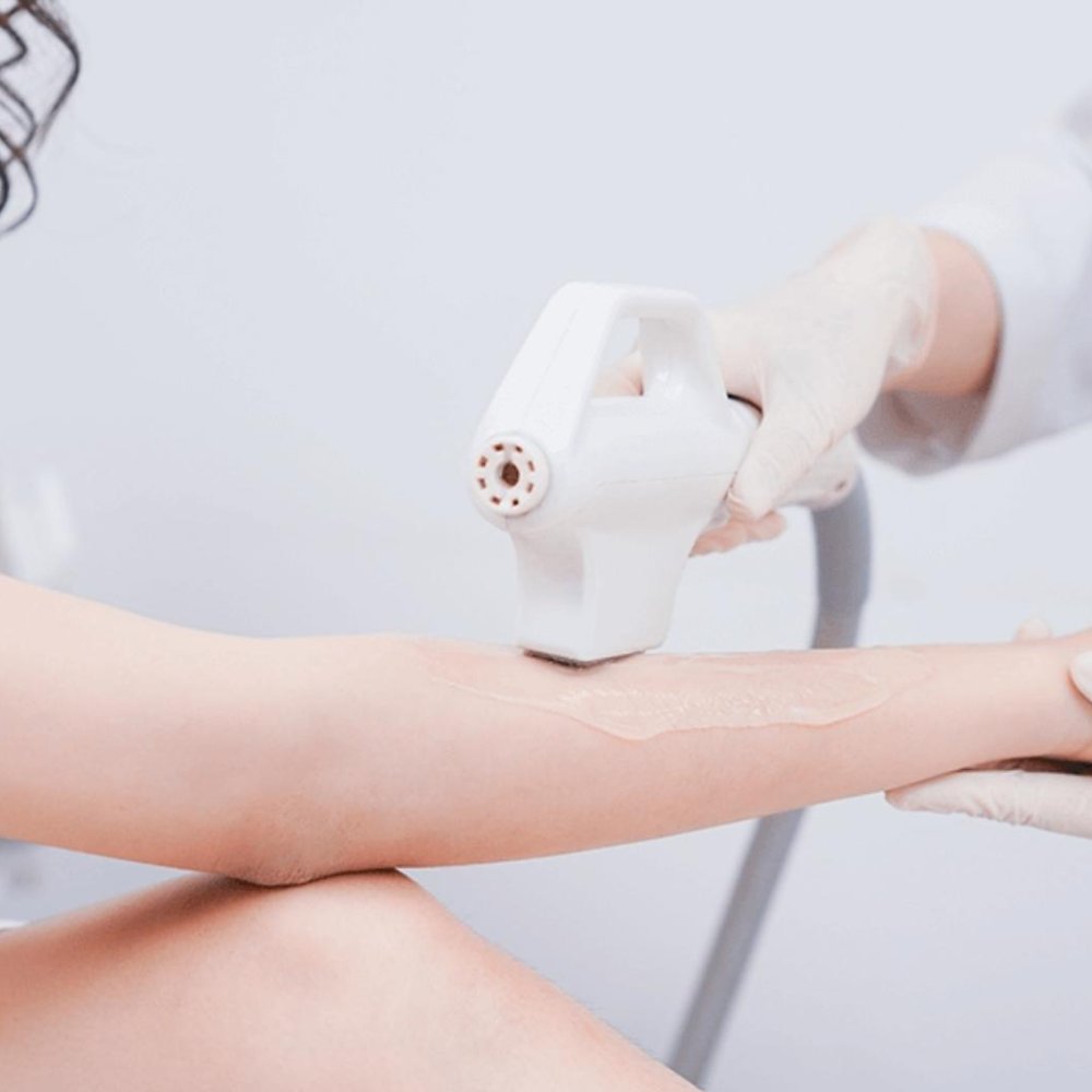 Triệt Lông Vĩnh Viễn Diode Laser 2026
