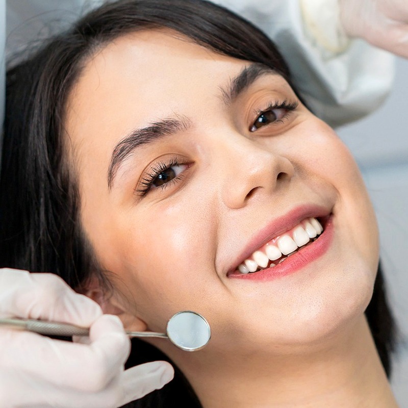 Dán Sứ Veneer