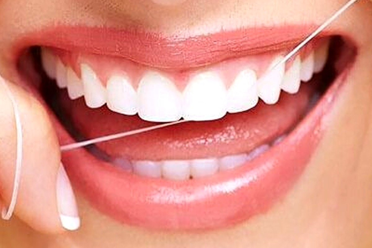 Cách vệ sinh răng khi đeo niềng